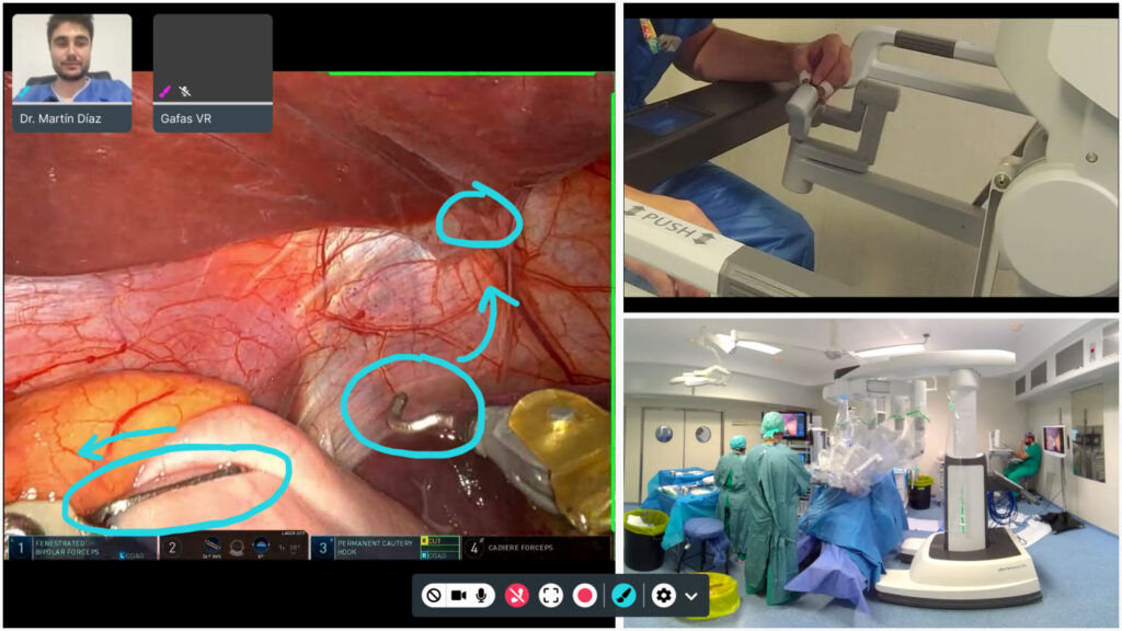 Fig. 1 Dynamic grid and digital whiteboard.  Video sources: participant cameras, Da Vinci console, lead surgeon at the controls of the surgical robot and 360 camera of the entire operating room.
